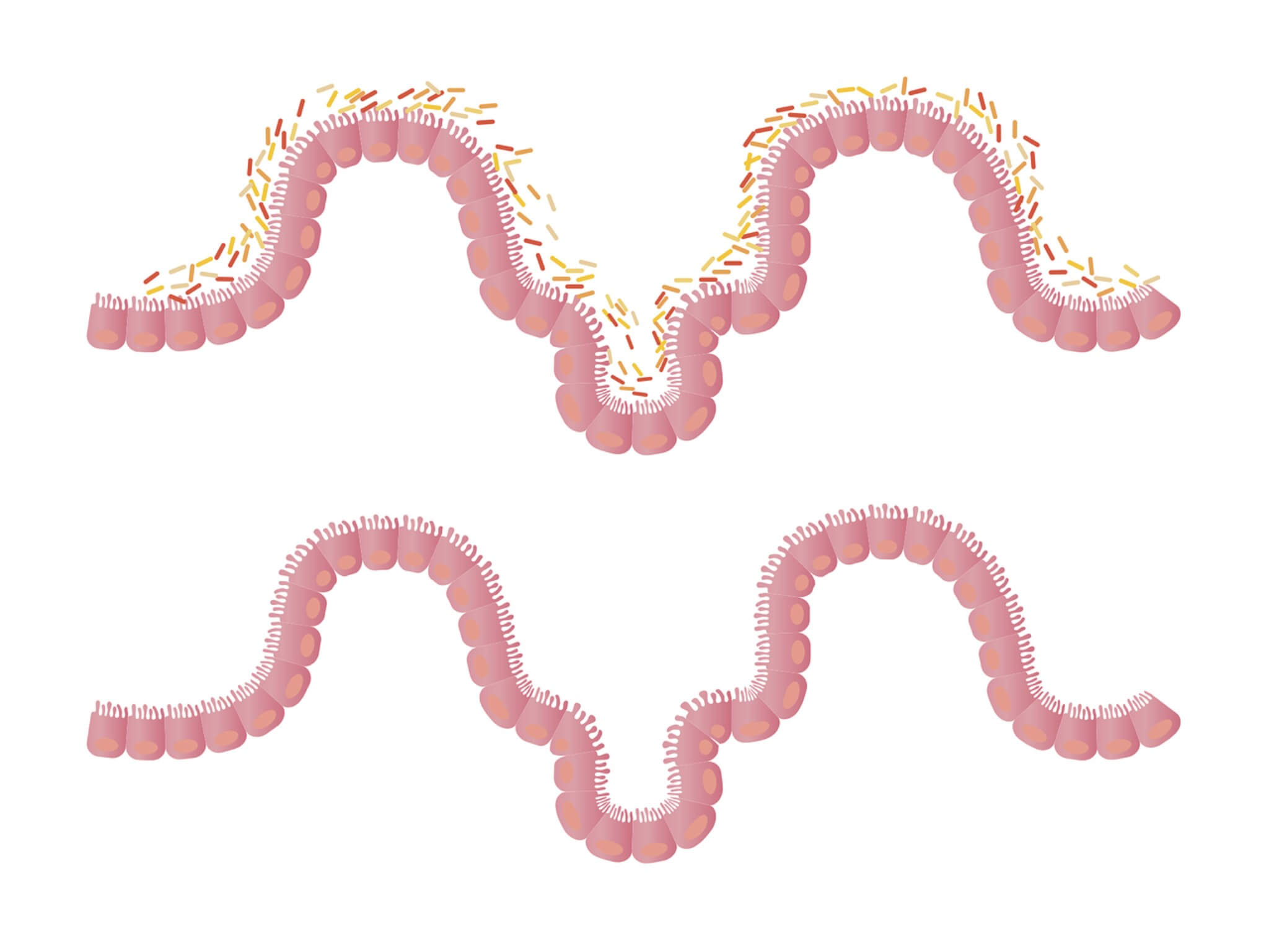 microbiota intestinale